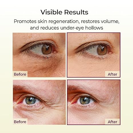 Dr.Melaxin Cemenrete Calcium Multi Balm 9g Korean Skin Care All In One Calcium Volume Stick Collagen Wrinkles Face Eye treatment Balm